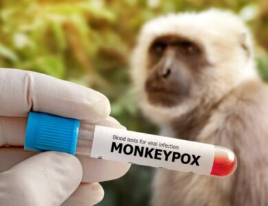 الوباء الصامت يقتل في زامبيا.. 4 وفيات وأكثر من 1000 إصابة - أخبار السعودية