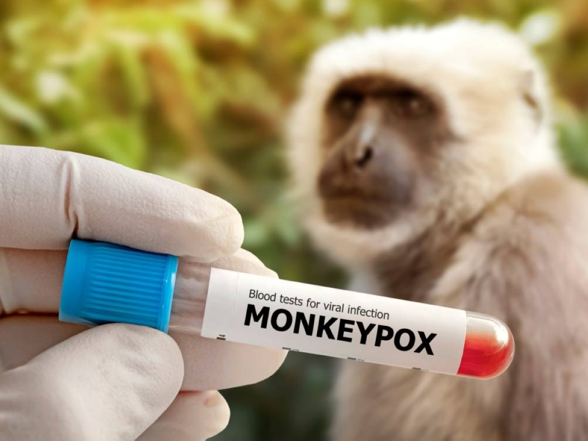 الوباء الصامت يقتل في زامبيا.. 4 وفيات وأكثر من 1000 إصابة - أخبار السعودية