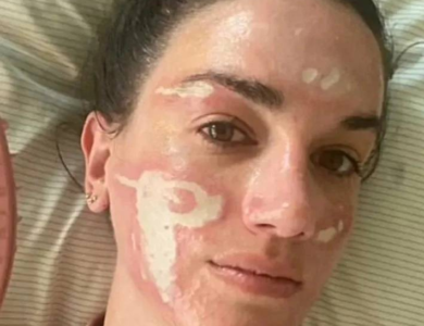 شابة تتهم خبيرة تجميل هوليوودية بتشويه وجهها إلى الأبد - أخبار السعودية