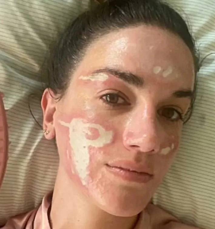 شابة تتهم خبيرة تجميل هوليوودية بتشويه وجهها إلى الأبد - أخبار السعودية